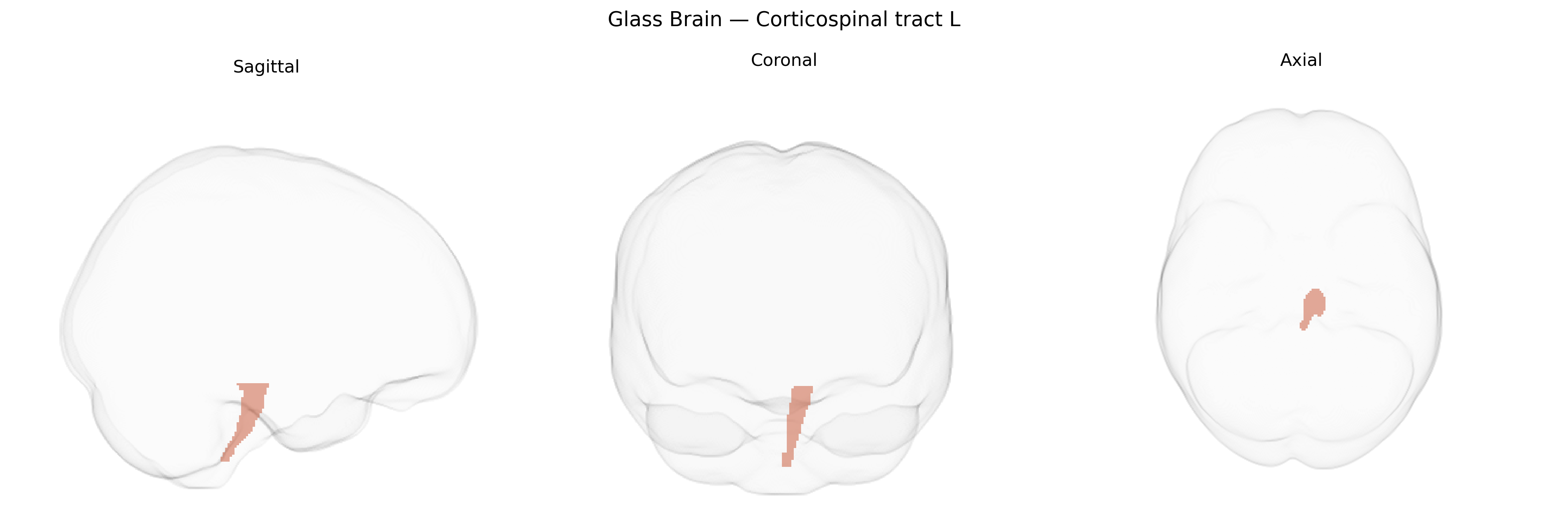 Triplanar Ghost Brain