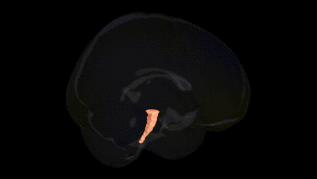 Full Brain Black