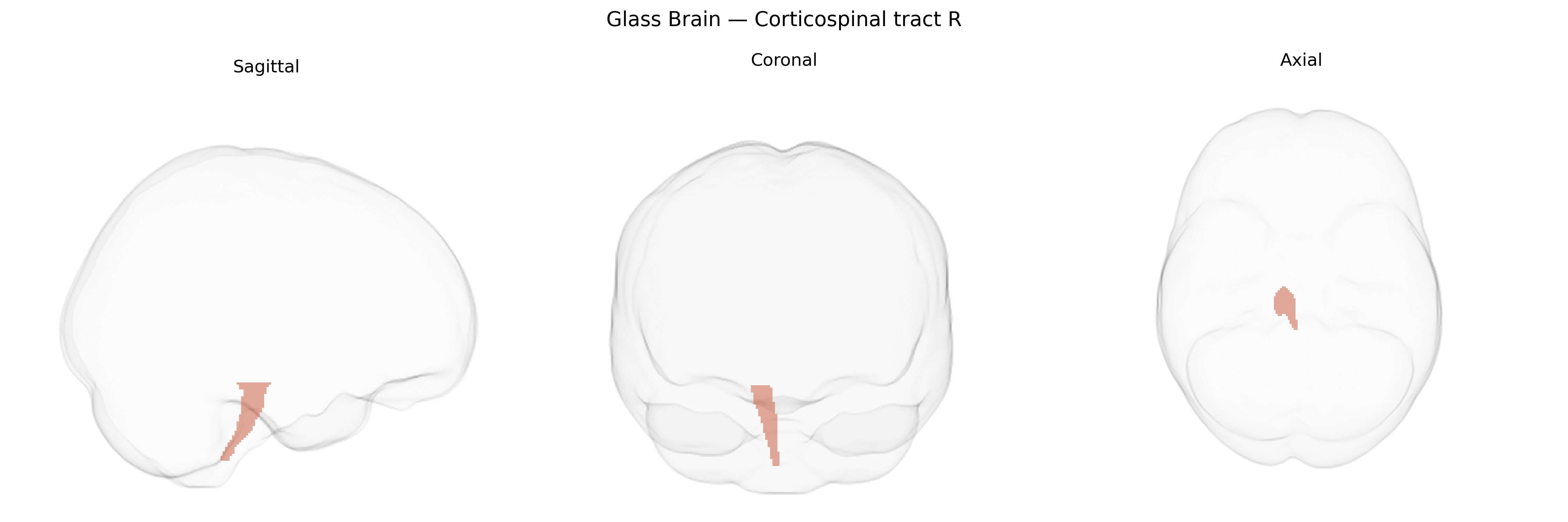 Triplanar Ghost Brain