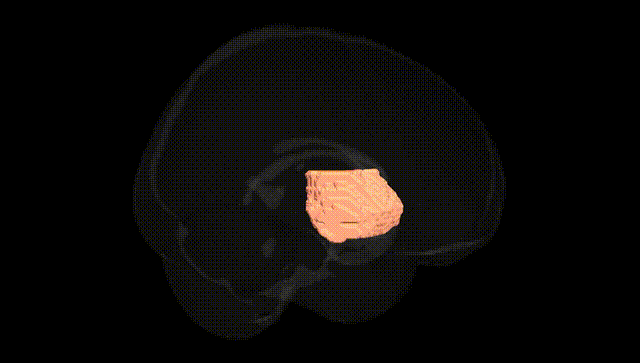 Full Brain Black