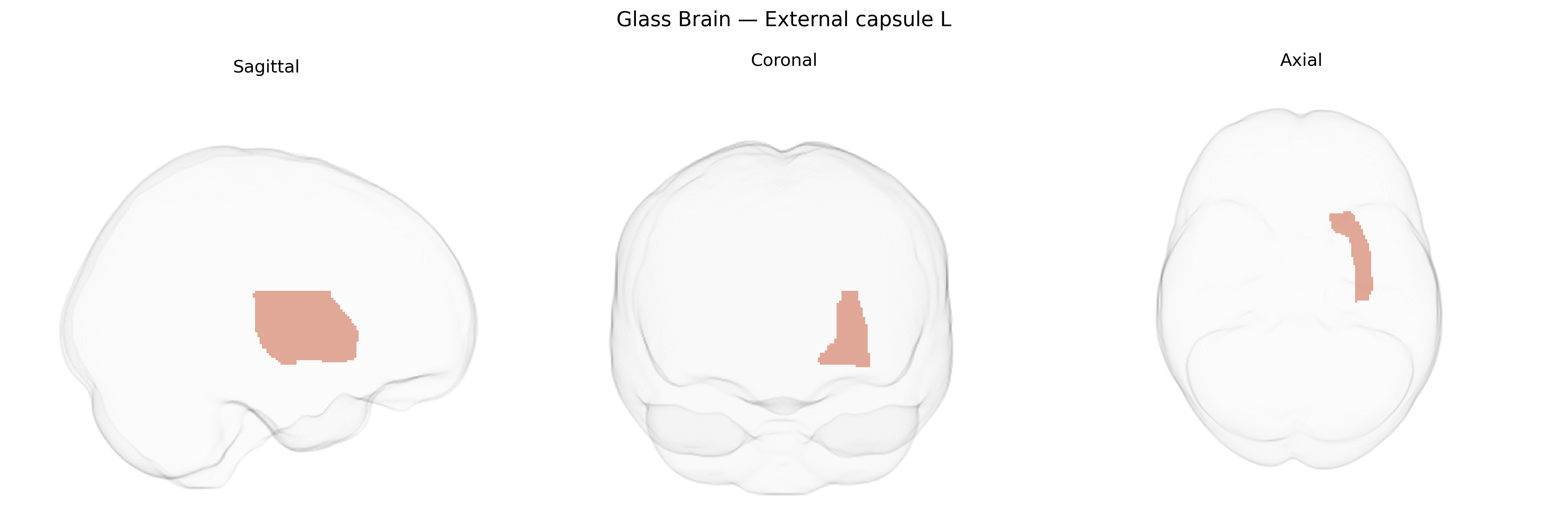 Triplanar Ghost Brain