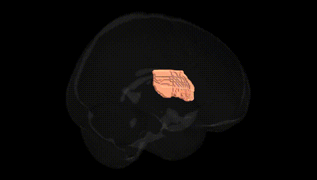 Full Brain Black