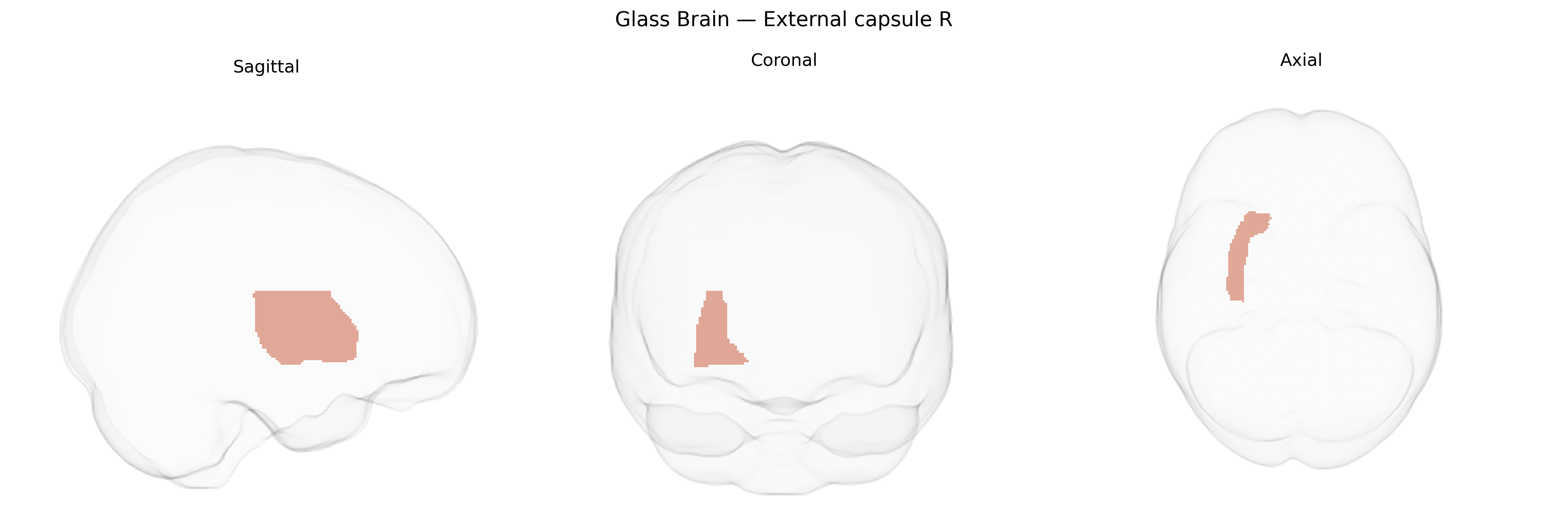 Triplanar Ghost Brain