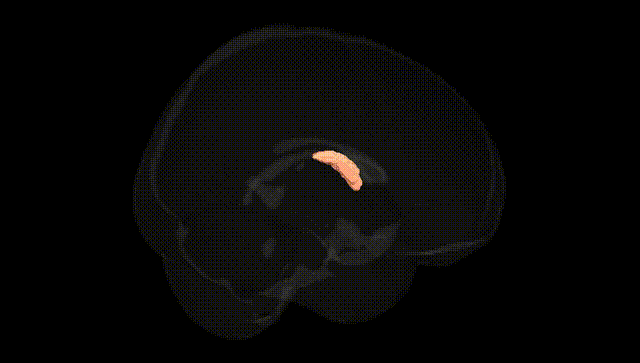Full Brain Black