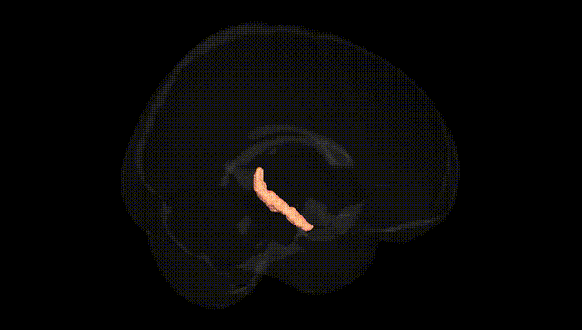 Full Brain Black