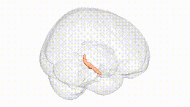 Full Brain White