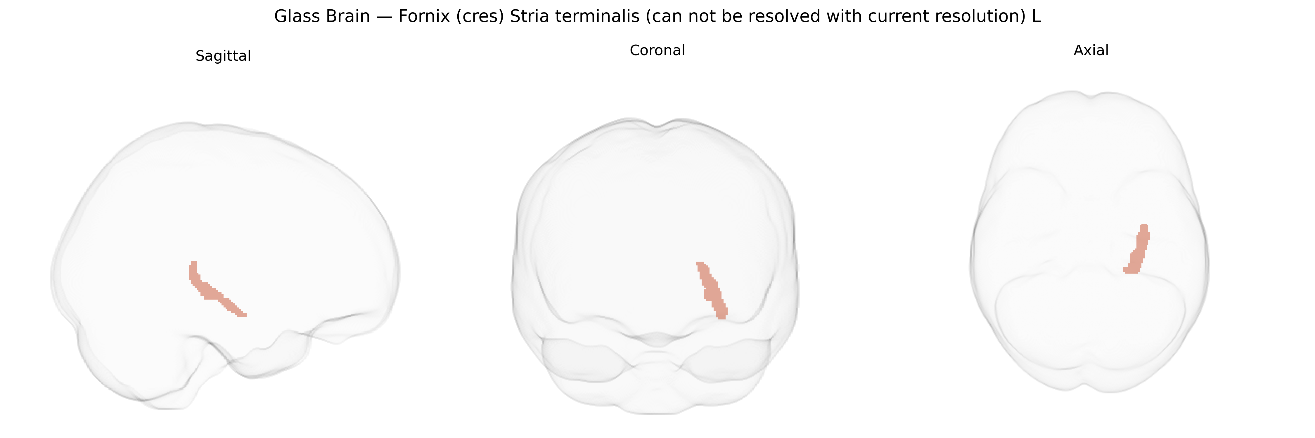 Triplanar Ghost Brain