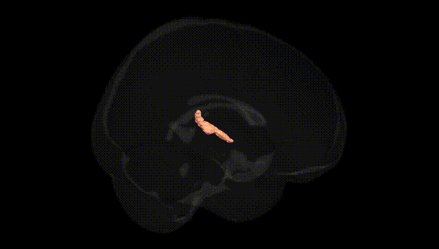 Full Brain Black