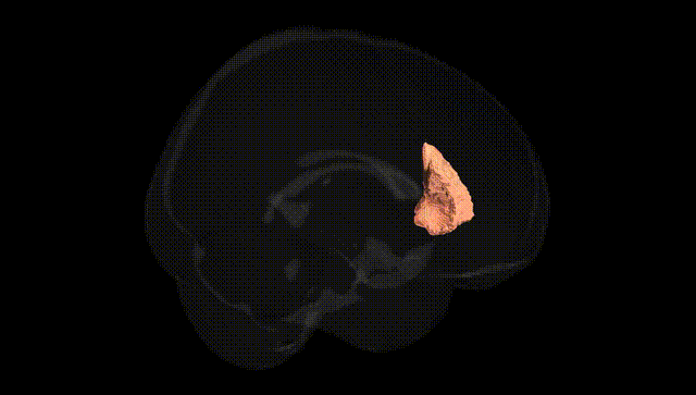 Full Brain Black