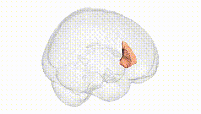 Full Brain White