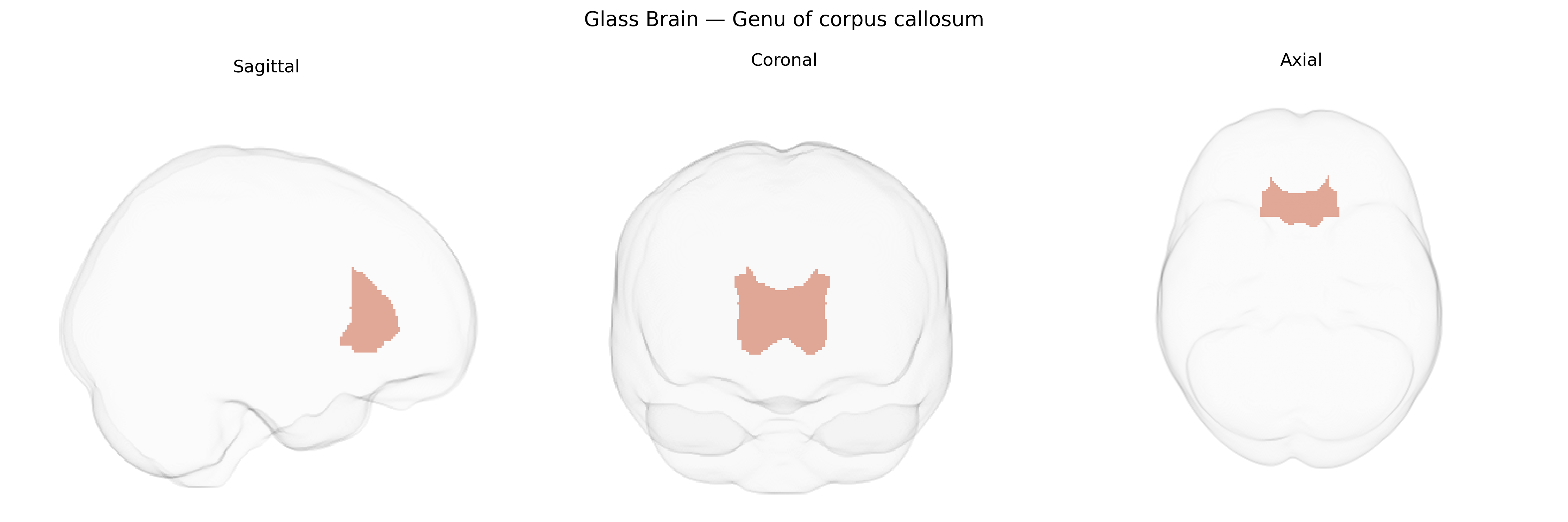 Triplanar Ghost Brain