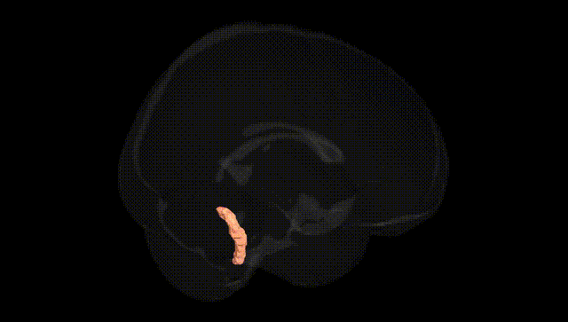 Full Brain Black