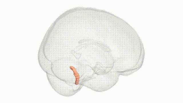 Full Brain White