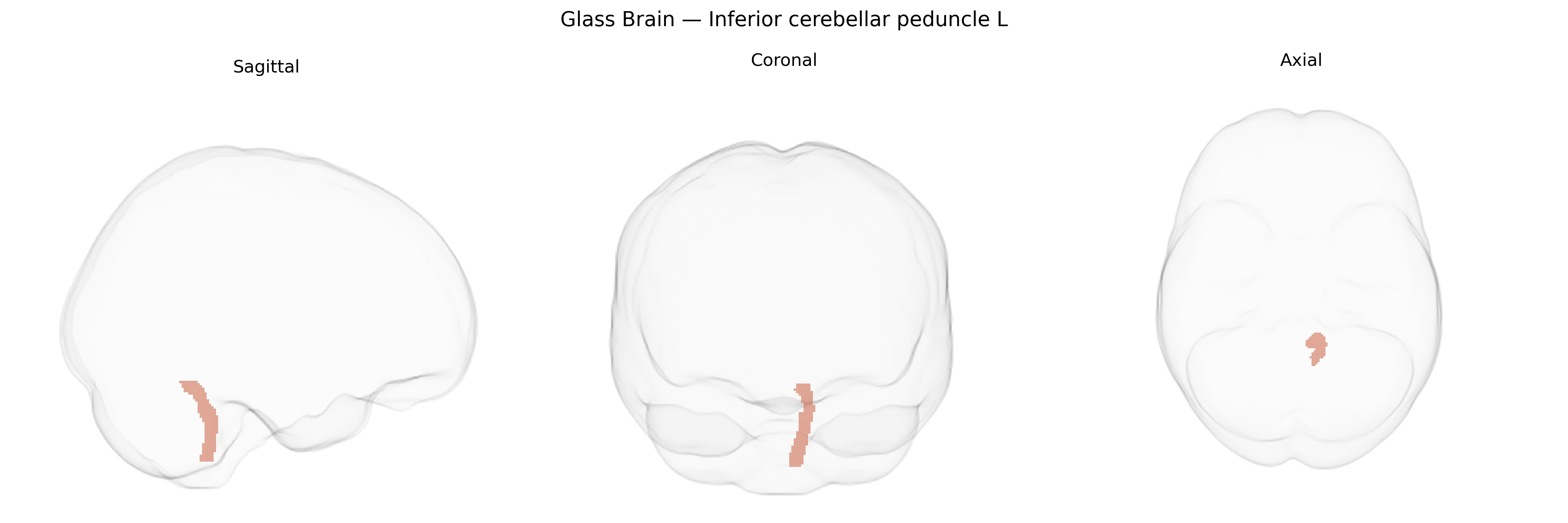 Triplanar Ghost Brain