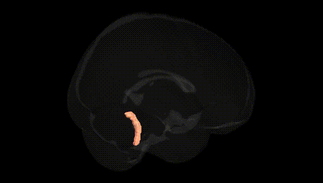 Full Brain Black