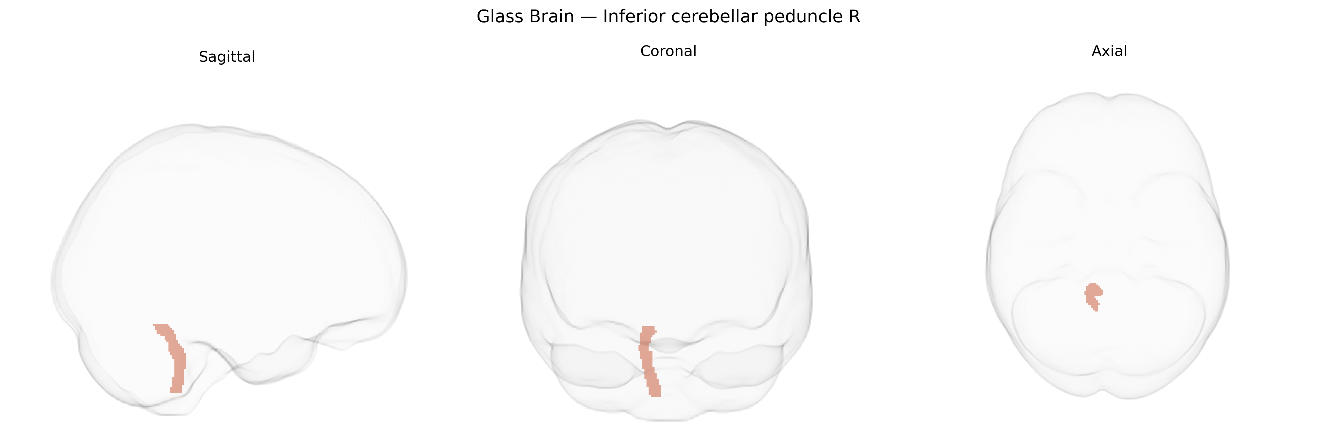 Triplanar Ghost Brain