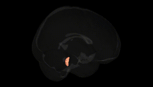 Full Brain Black