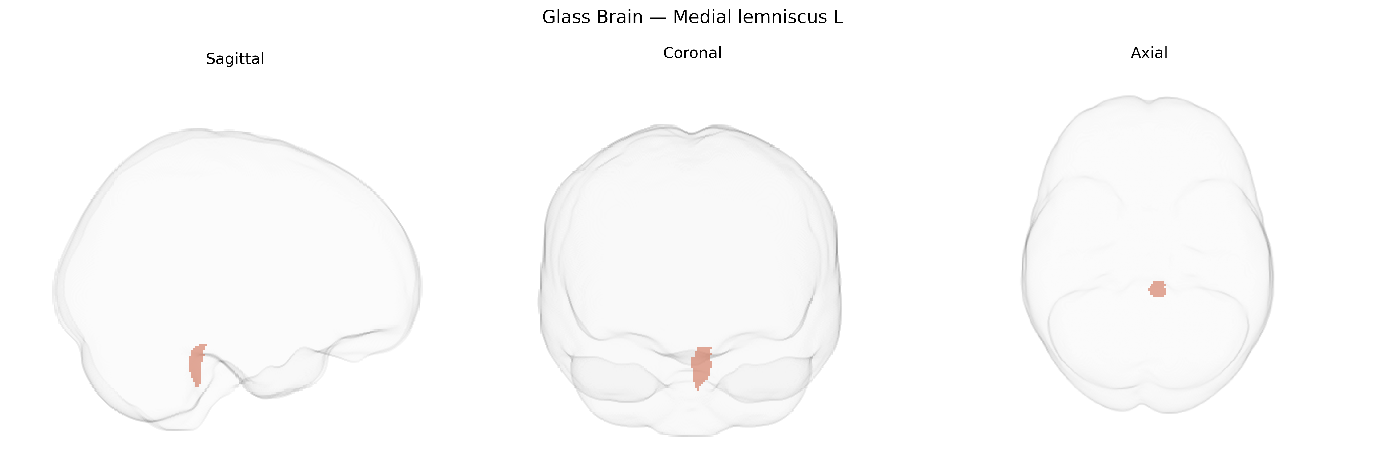 Triplanar Ghost Brain