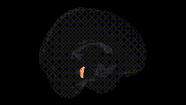 Full Brain Black