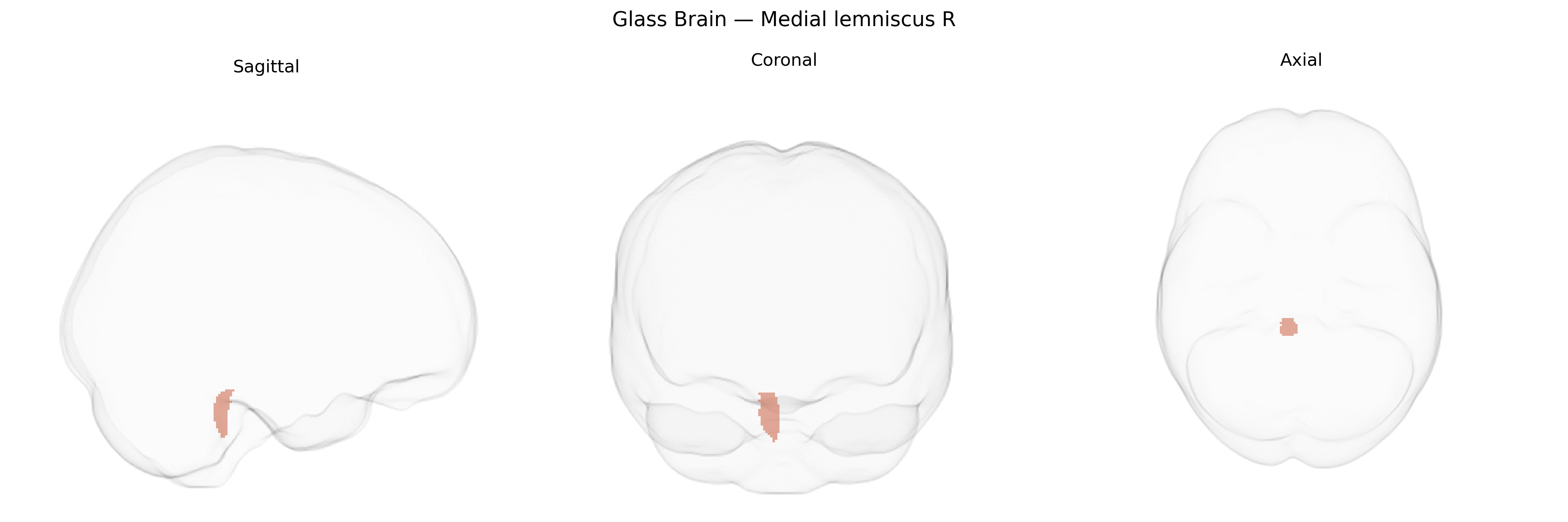 Triplanar Ghost Brain