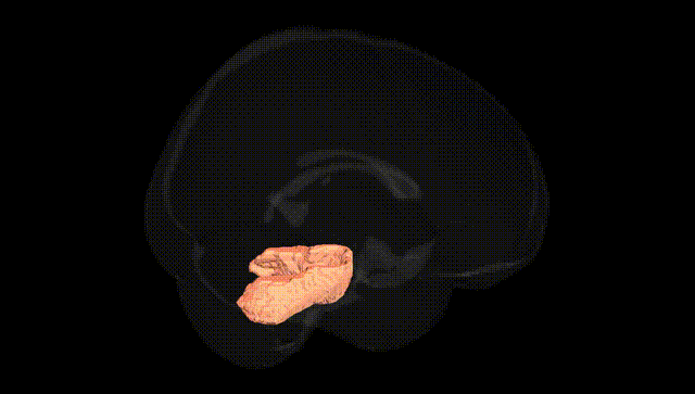 Full Brain Black