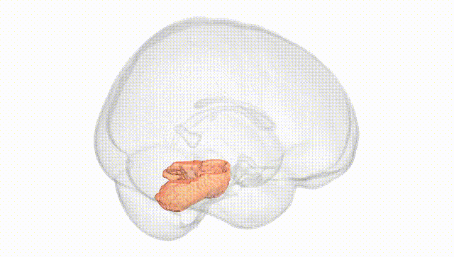Full Brain White