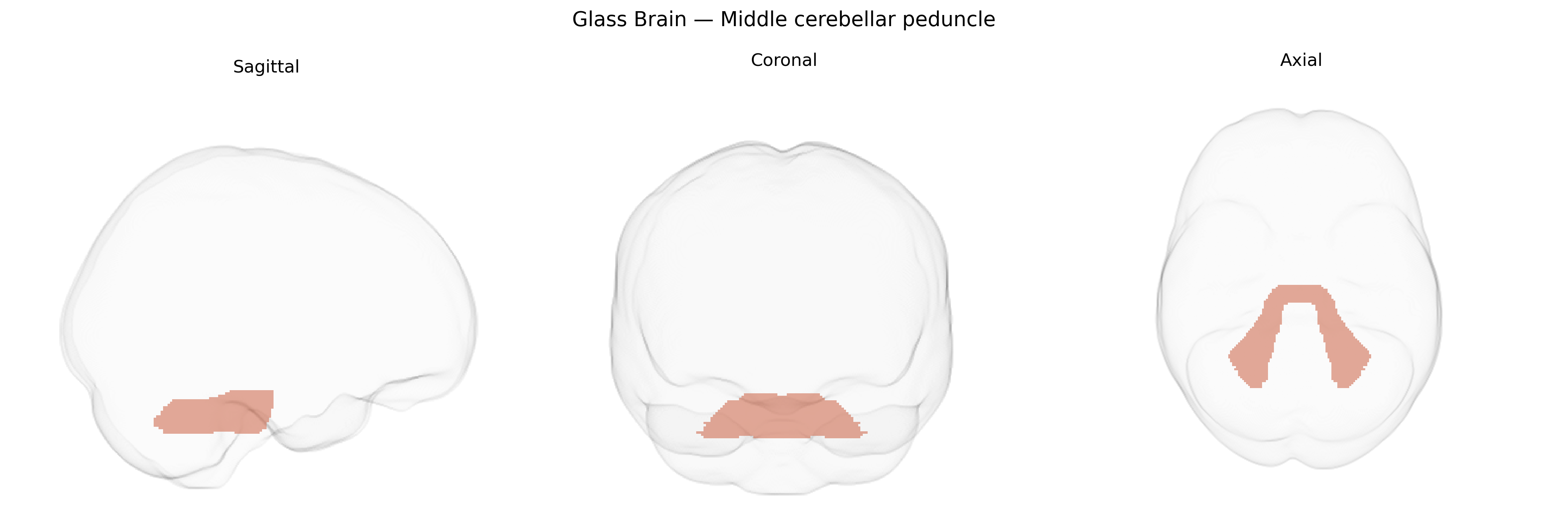 Triplanar Ghost Brain