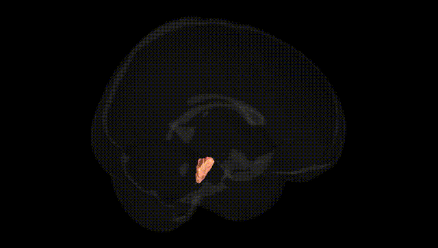 Full Brain Black