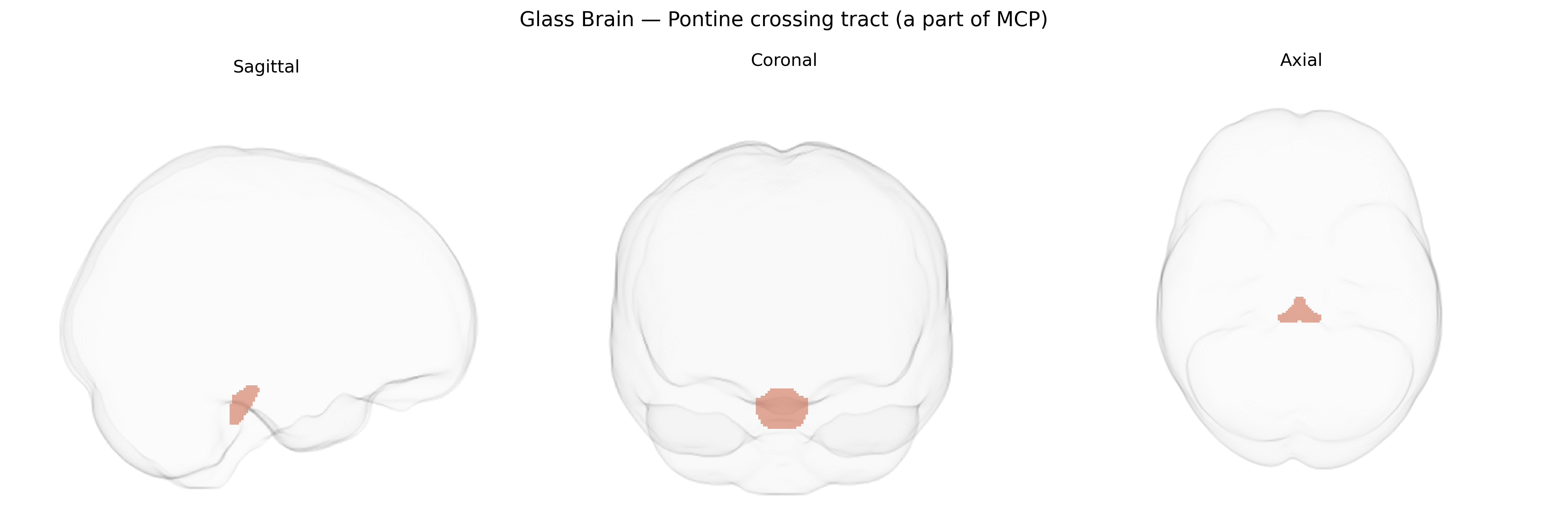 Triplanar Ghost Brain