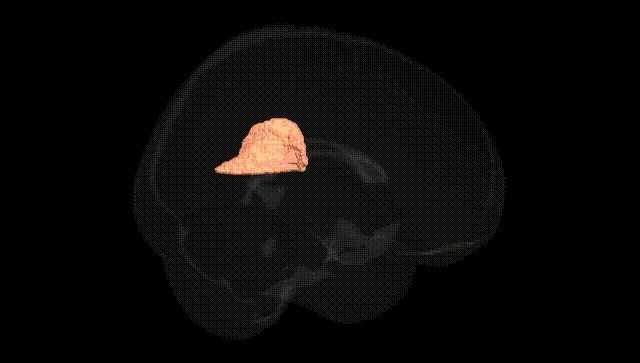 Full Brain Black
