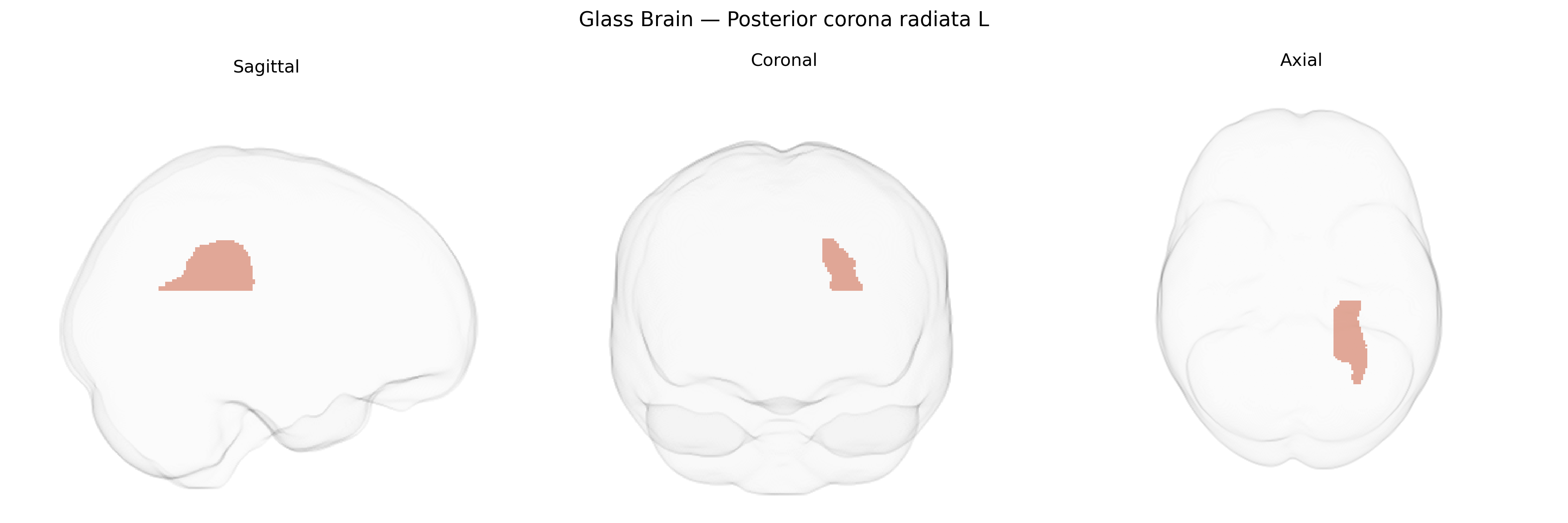 Triplanar Ghost Brain