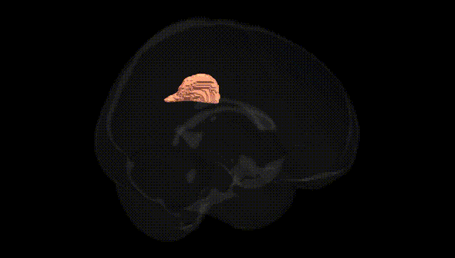 Full Brain Black