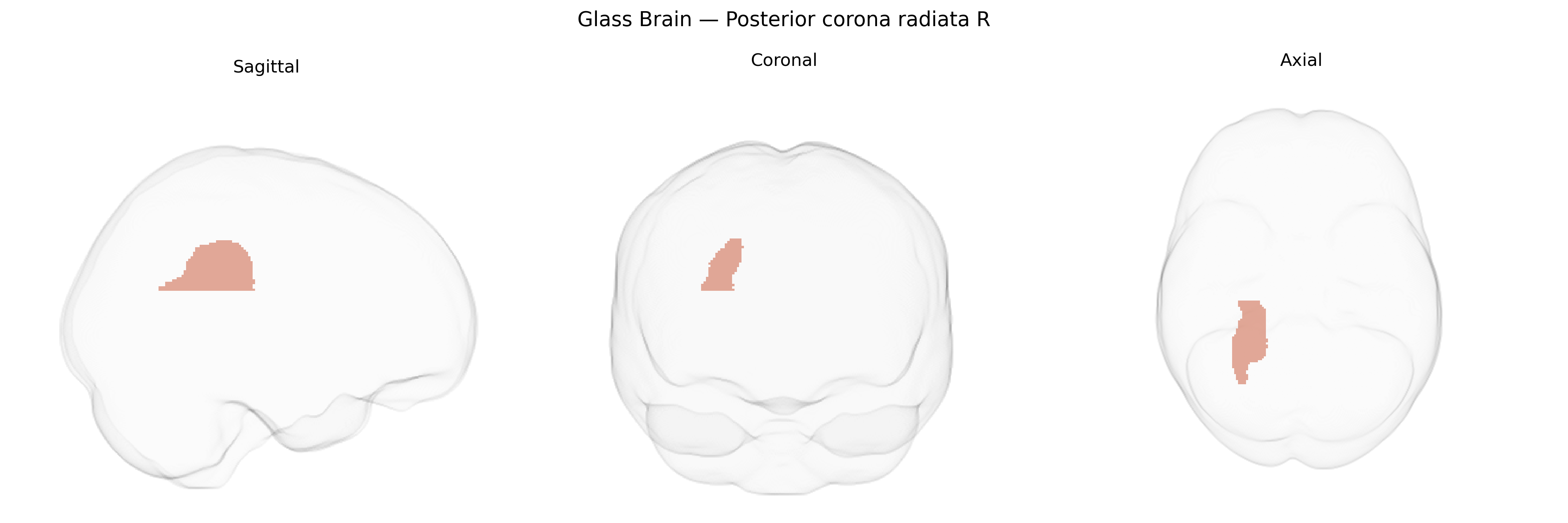 Triplanar Ghost Brain