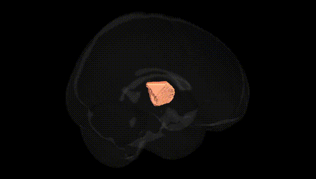 Full Brain Black