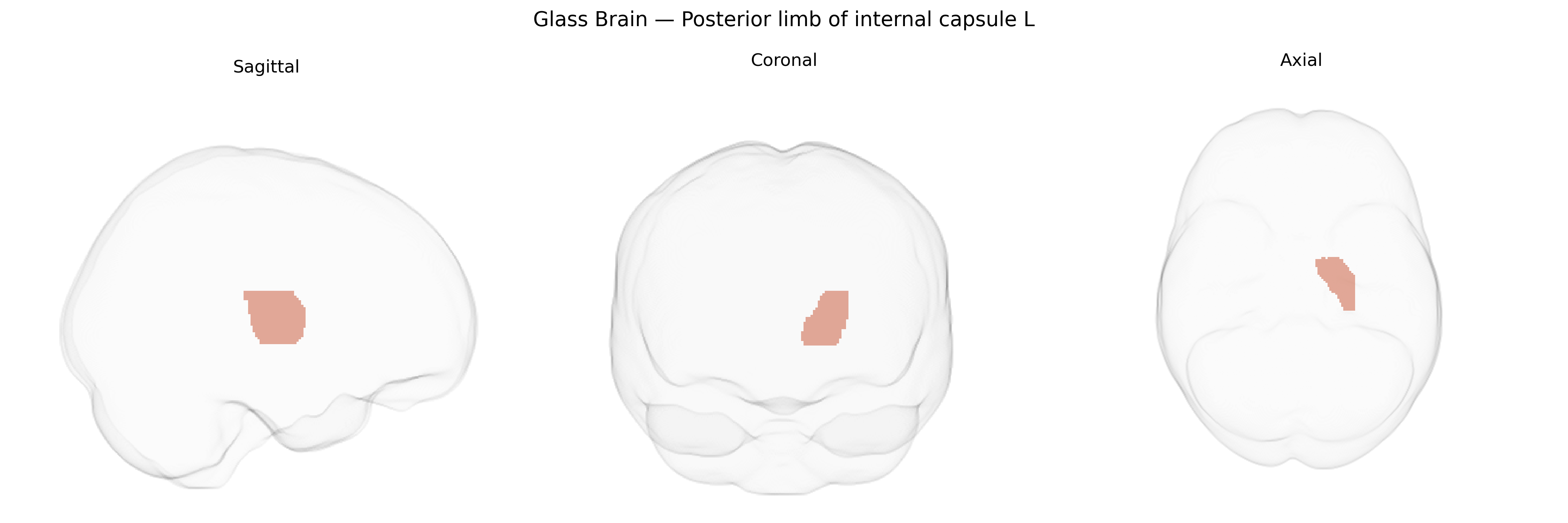 Triplanar Ghost Brain