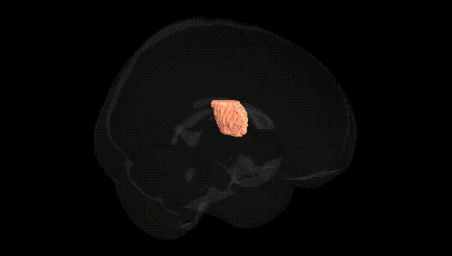 Full Brain Black