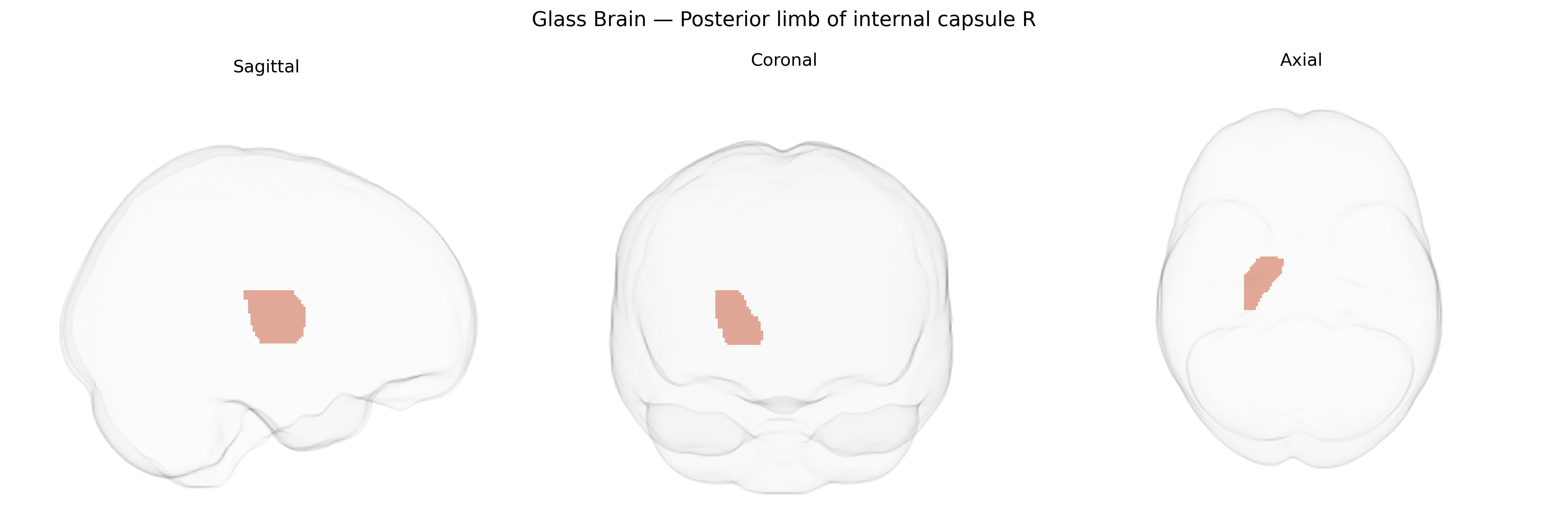 Triplanar Ghost Brain