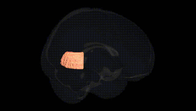 Full Brain Black