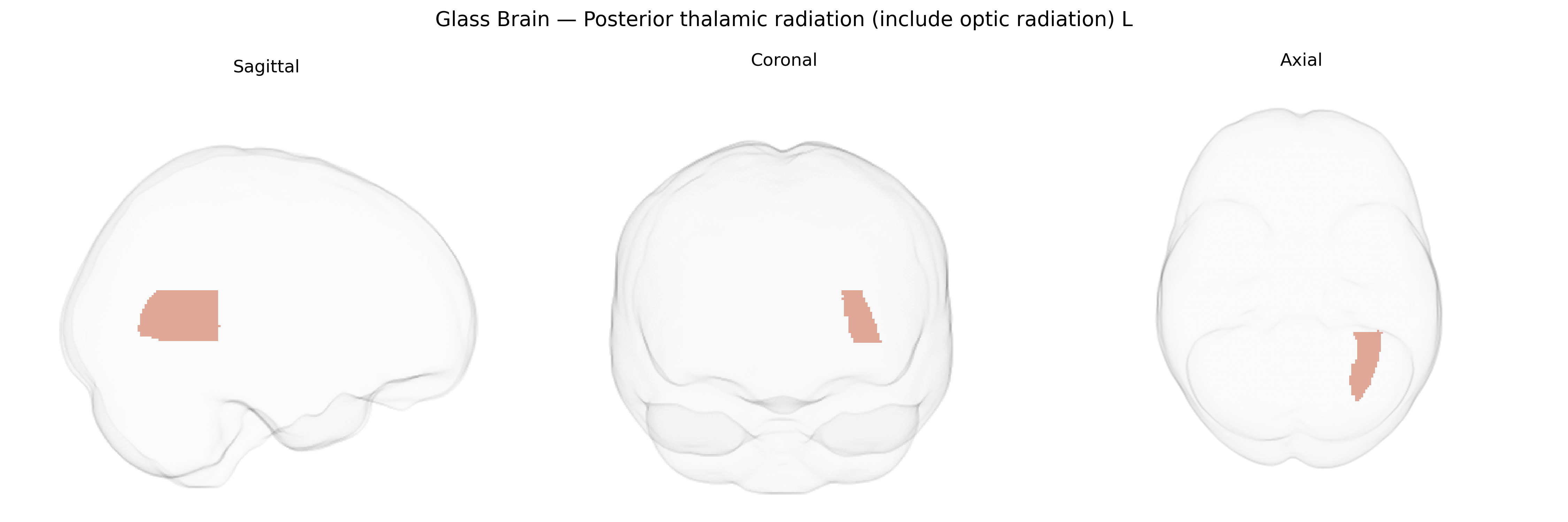 Triplanar Ghost Brain