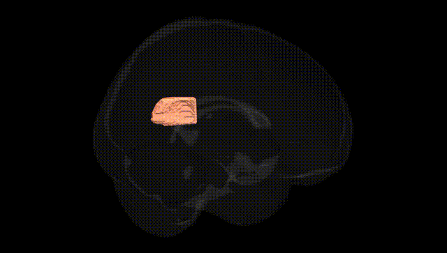 Full Brain Black