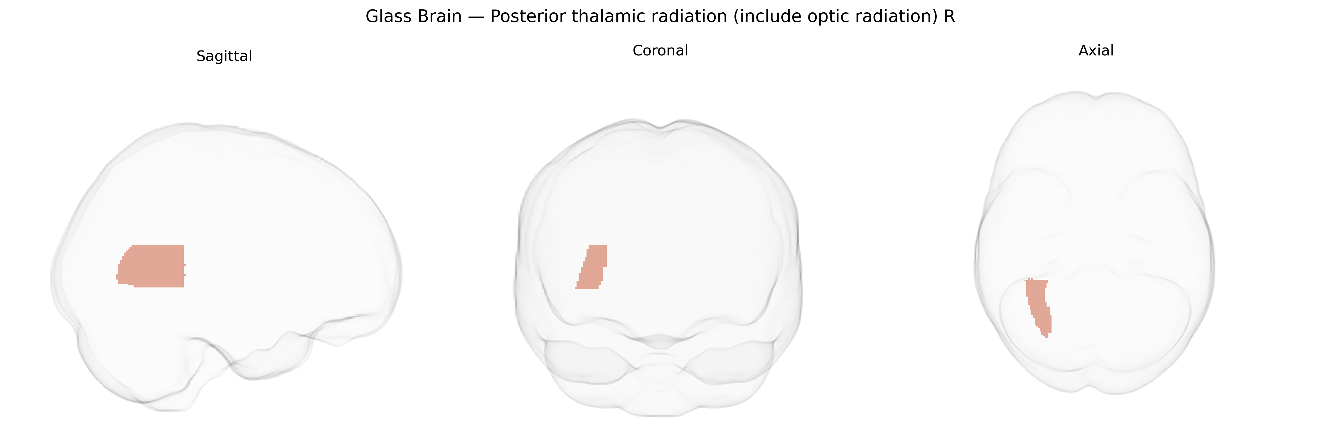 Triplanar Ghost Brain