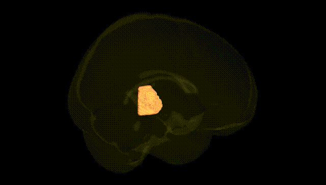 Full Brain Black