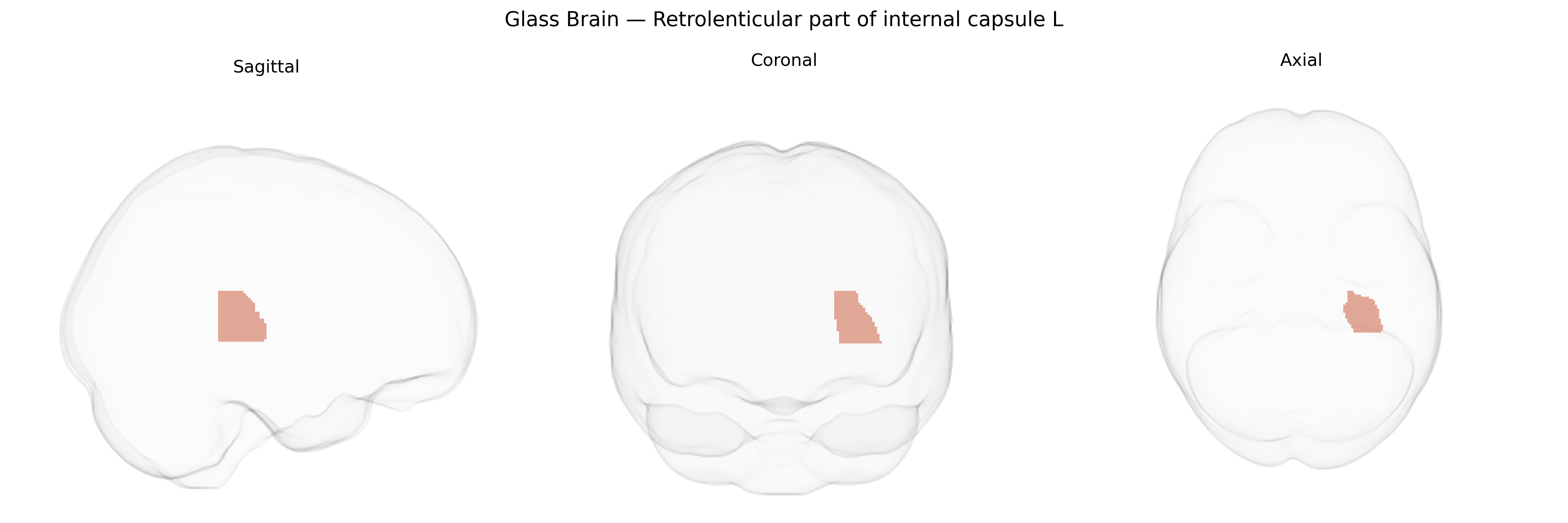 Triplanar Ghost Brain