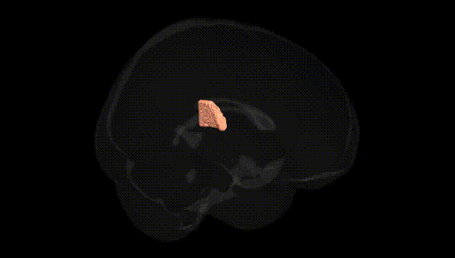 Full Brain Black