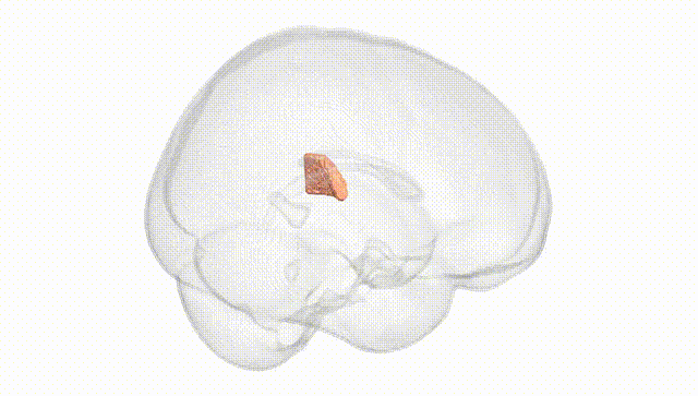 Full Brain White
