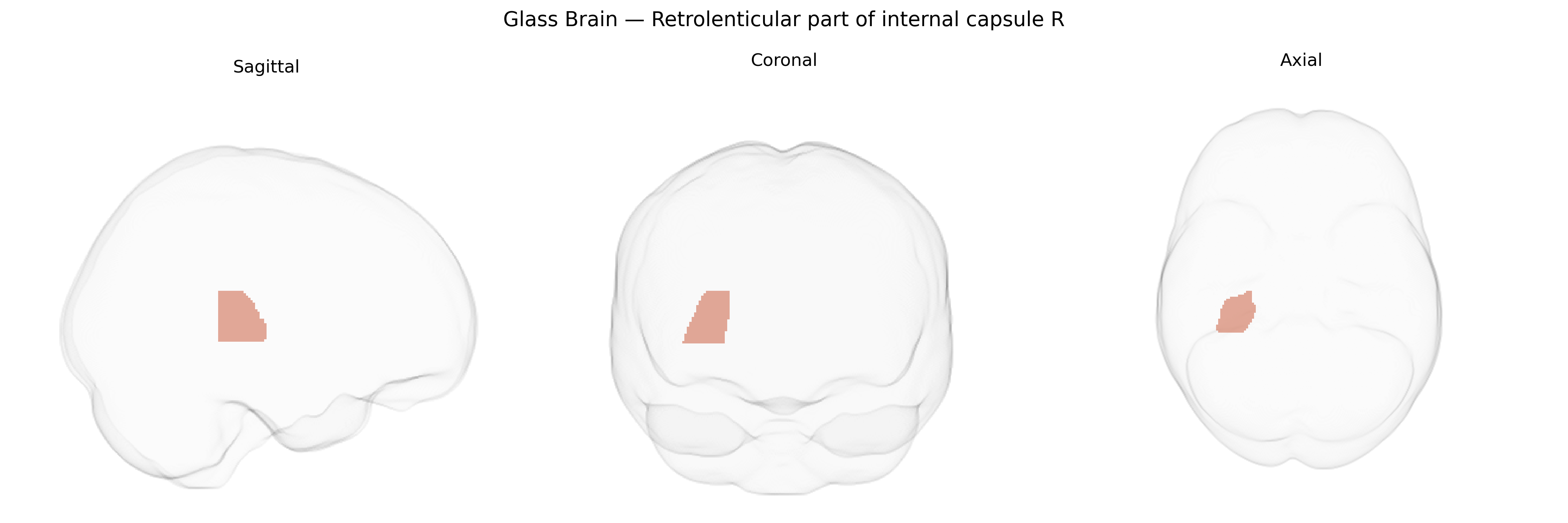 Triplanar Ghost Brain