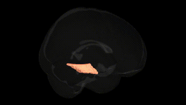 Full Brain Black