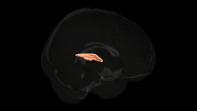 Full Brain Black