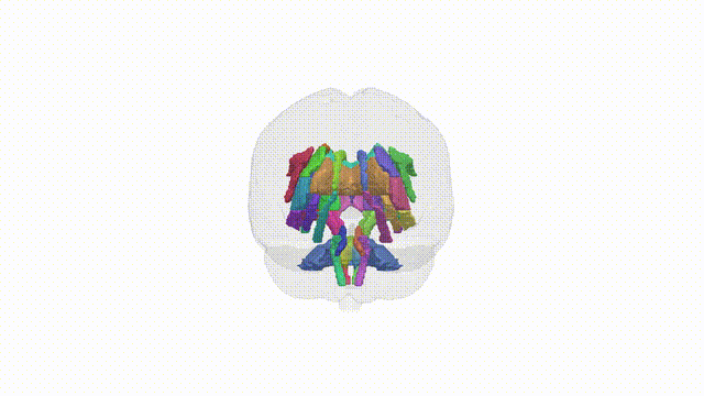 Rotating Brain