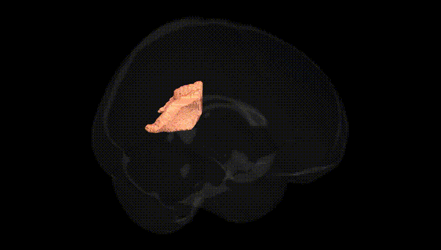 Full Brain Black